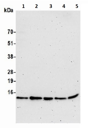 Western blot - Anti-VMA21 antibody (AB242115)