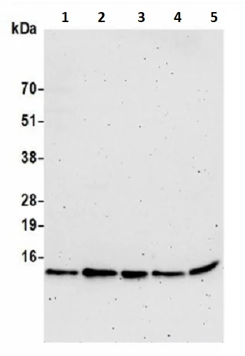 Western blot - Anti-VMA21 antibody (AB242115)