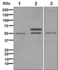 Western blot - Anti-VMAT1 antibody [EPR6476] - BSA and Azide free (AB249447), expandable thumbnail