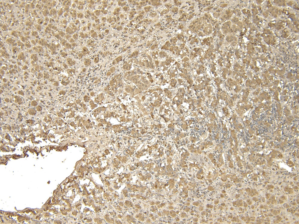 Immunohistochemistry (Formalin/PFA-fixed paraffin-embedded sections) - Anti-VMAT2 antibody (AB26073)