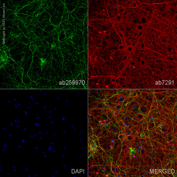 Immunocytochemistry/ Immunofluorescence - Anti-VMAT2 antibody [EPR24197-51] (ab259970), expandable thumbnail