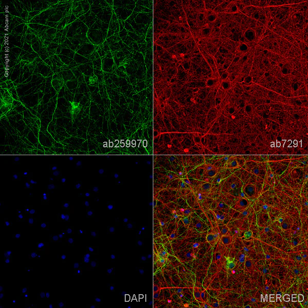 Immunocytochemistry/ Immunofluorescence - Anti-VMAT2 antibody [EPR24197-51] (AB259970)