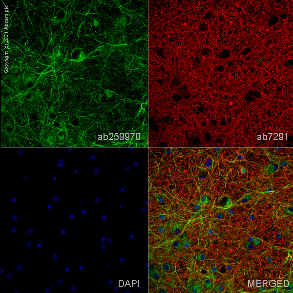 Immunocytochemistry/ Immunofluorescence - Anti-VMAT2 antibody [EPR24197-51] (ab259970), expandable thumbnail