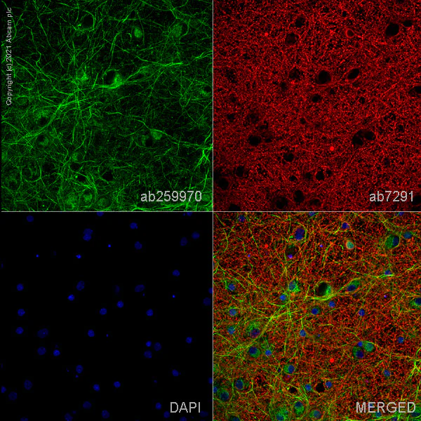 Immunocytochemistry/ Immunofluorescence - Anti-VMAT2 antibody [EPR24197-51] (AB259970)
