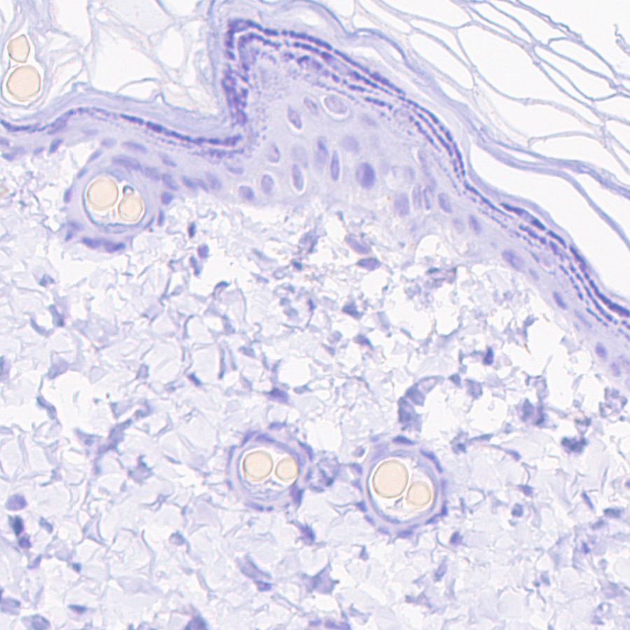 Immunohistochemistry (Formalin/PFA-fixed paraffin-embedded sections) - Anti-VMAT2 antibody [EPR24197-51] (ab259970), expandable thumbnail
