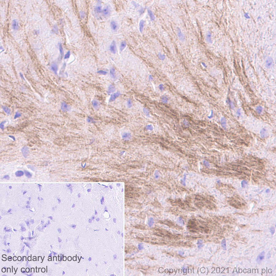 Immunohistochemistry (Formalin/PFA-fixed paraffin-embedded sections) - Anti-VMAT2 antibody [EPR24197-51] (AB259970), expandable thumbnail