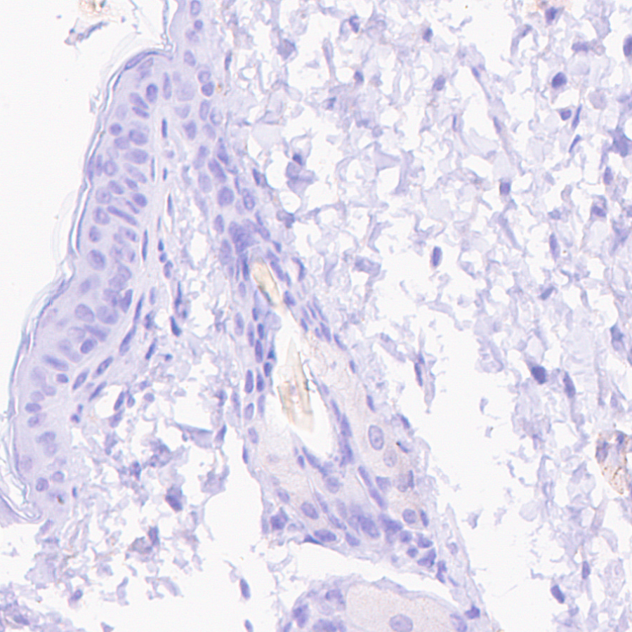 Immunohistochemistry (Formalin/PFA-fixed paraffin-embedded sections) - Anti-VMAT2 antibody [EPR24197-51] (ab259970), expandable thumbnail
