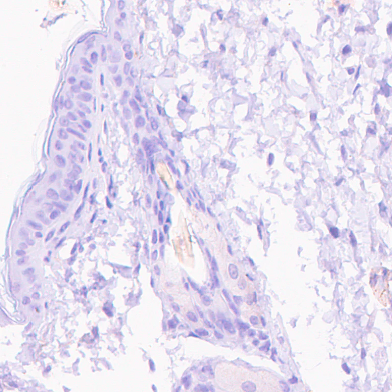 Immunohistochemistry (Formalin/PFA-fixed paraffin-embedded sections) - Anti-VMAT2 antibody [EPR24197-51] (AB259970)