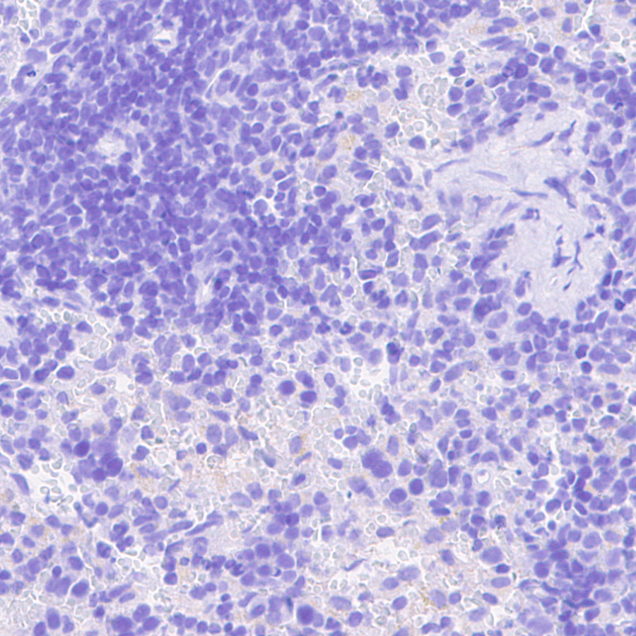 Immunohistochemistry (Formalin/PFA-fixed paraffin-embedded sections) - Anti-VMAT2 antibody [EPR24197-51] (ab259970), expandable thumbnail