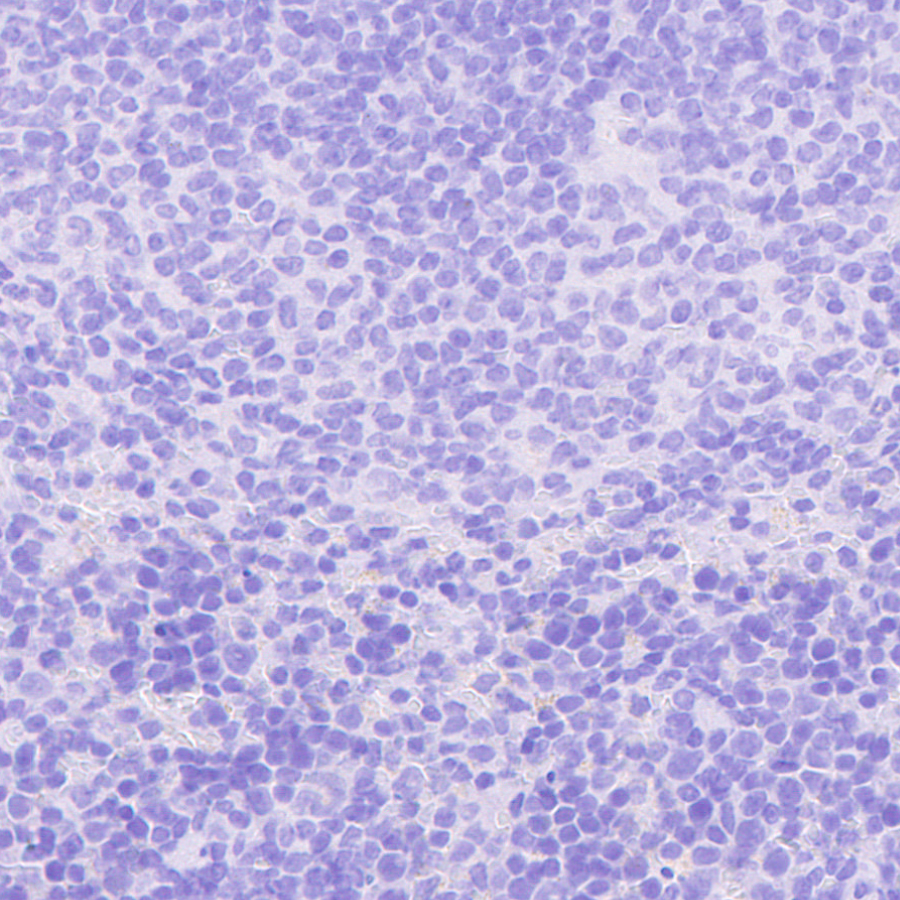 Immunohistochemistry (Formalin/PFA-fixed paraffin-embedded sections) - Anti-VMAT2 antibody [EPR24197-51] (ab259970), expandable thumbnail