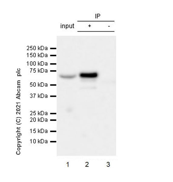 Immunoprecipitation - Anti-VMAT2 antibody [EPR24197-51] (ab259970), expandable thumbnail