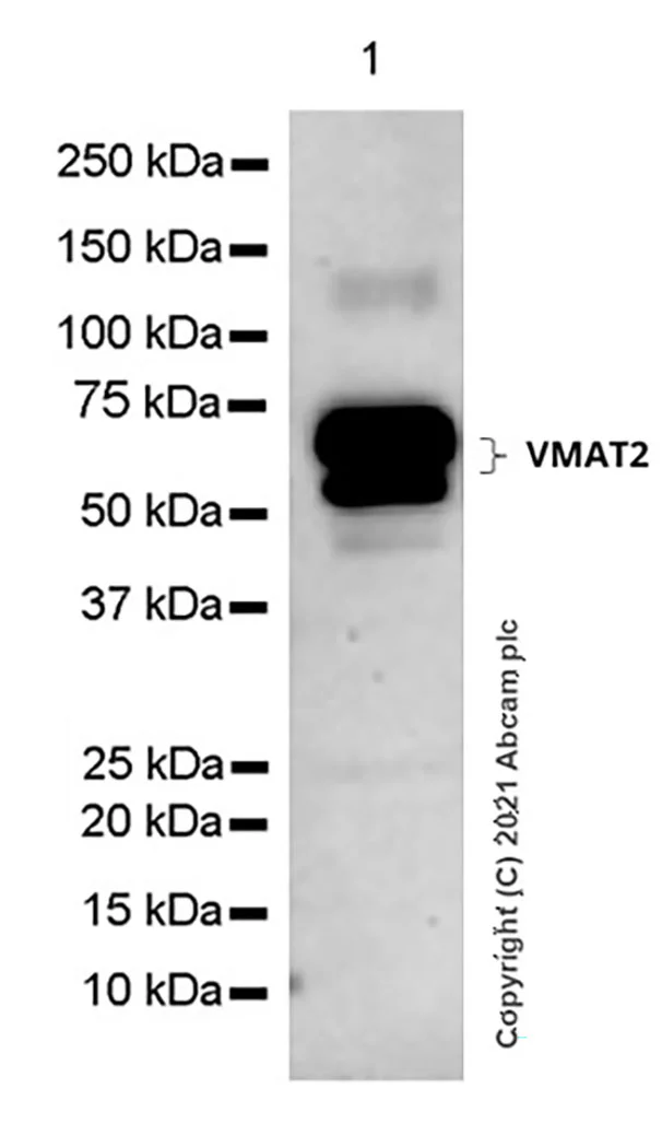 Western blot - Anti-VMAT2 antibody [EPR24197-51] (AB259970)