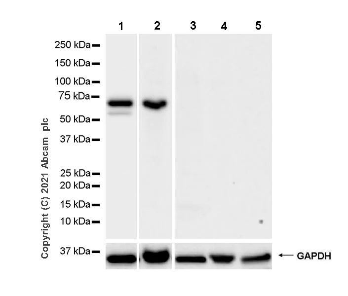 Western blot - Anti-VMAT2 antibody [EPR24197-51] (AB259970)