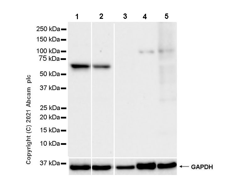 Western blot - Anti-VMAT2 antibody [EPR24197-51] (AB259970), expandable thumbnail