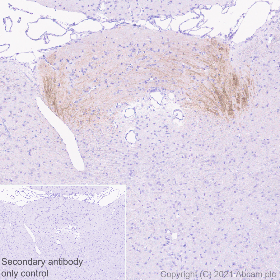 Immunohistochemistry (Formalin/PFA-fixed paraffin-embedded sections) - Anti-VMAT2 antibody [EPR24197-51] - BSA and Azide free (AB280364), expandable thumbnail