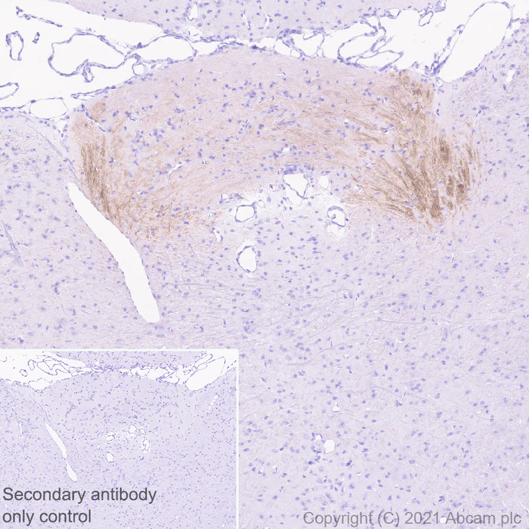 Immunohistochemistry (Formalin/PFA-fixed paraffin-embedded sections) - Anti-VMAT2 antibody [EPR24197-51] - BSA and Azide free (AB280364)