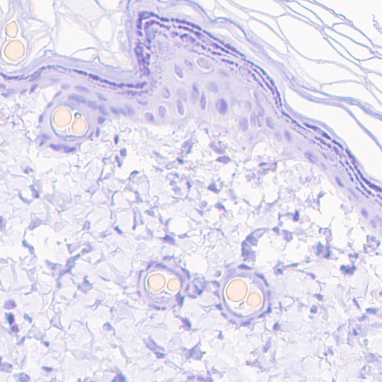 Immunohistochemistry (Formalin/PFA-fixed paraffin-embedded sections) - Anti-VMAT2 antibody [EPR24197-51] - BSA and Azide free (AB280364)