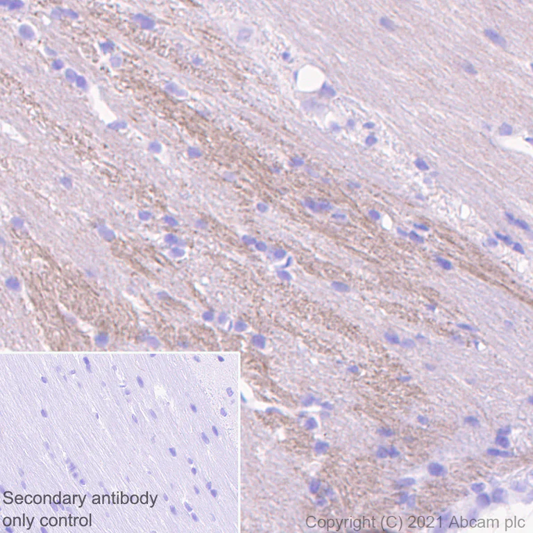 Immunohistochemistry (Formalin/PFA-fixed paraffin-embedded sections) - Anti-VMAT2 antibody [EPR24197-51] - BSA and Azide free (AB280364)