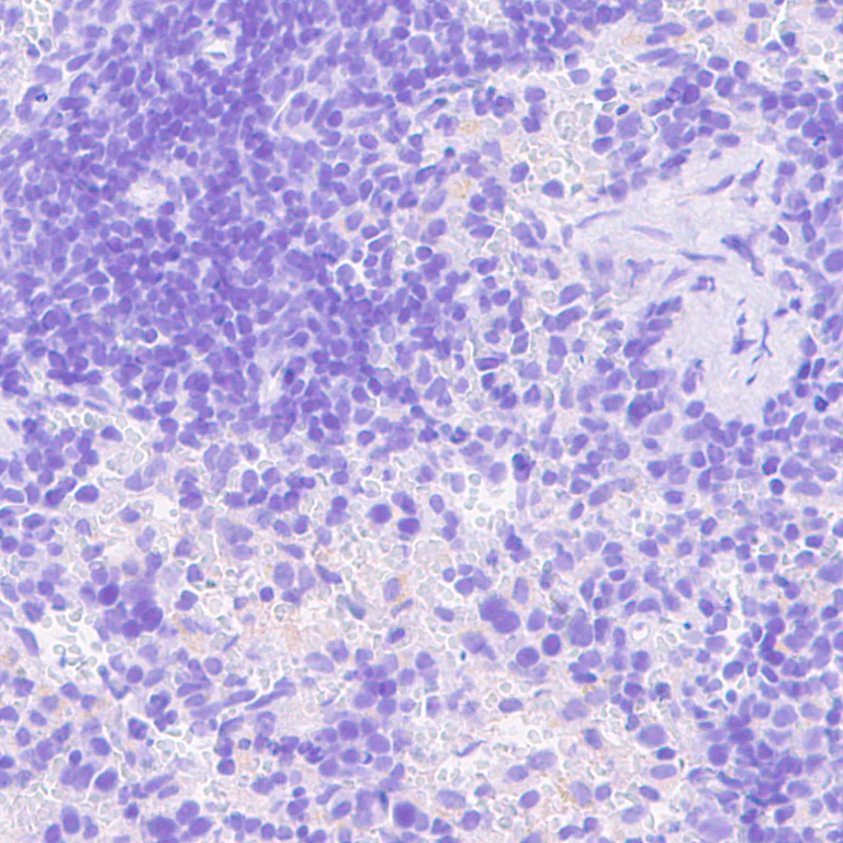 Immunohistochemistry (Formalin/PFA-fixed paraffin-embedded sections) - Anti-VMAT2 antibody [EPR24197-51] - BSA and Azide free (AB280364)
