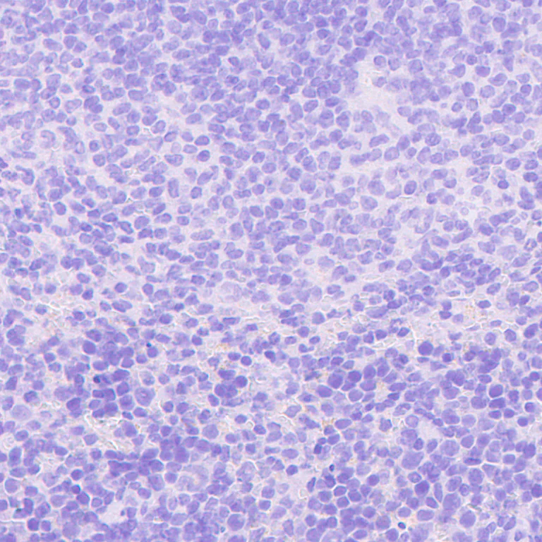 Immunohistochemistry (Formalin/PFA-fixed paraffin-embedded sections) - Anti-VMAT2 antibody [EPR24197-51] - BSA and Azide free (AB280364)
