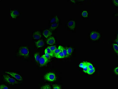 Immunocytochemistry/ Immunofluorescence - Anti-VN1R2 antibody (AB237679)