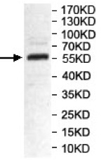 Western blot - Anti-VNN1/Vanin-1 antibody (AB205912), expandable thumbnail