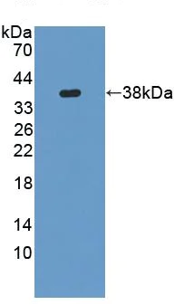 Western blot - Anti-VNN1/Vanin-1 antibody (AB231056)