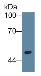 Western blot - Anti-VNN1/Vanin-1 antibody (AB231056)