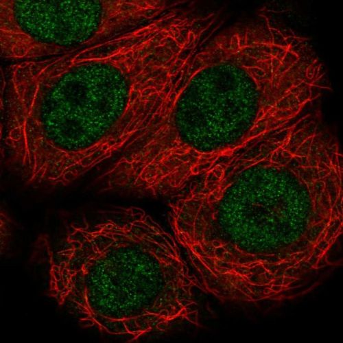 Immunocytochemistry/ Immunofluorescence - Anti-Von Hippel Lindau/VHL antibody (AB244445), expandable thumbnail