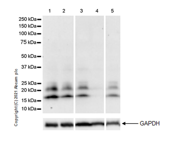 Western blot - Anti-Von Hippel Lindau/VHL antibody [EPR24354-128] (AB270968)