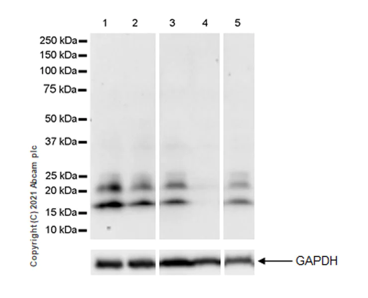 Western blot - Anti-Von Hippel Lindau/VHL antibody [EPR24354-128] - BSA and Azide free (AB282120)