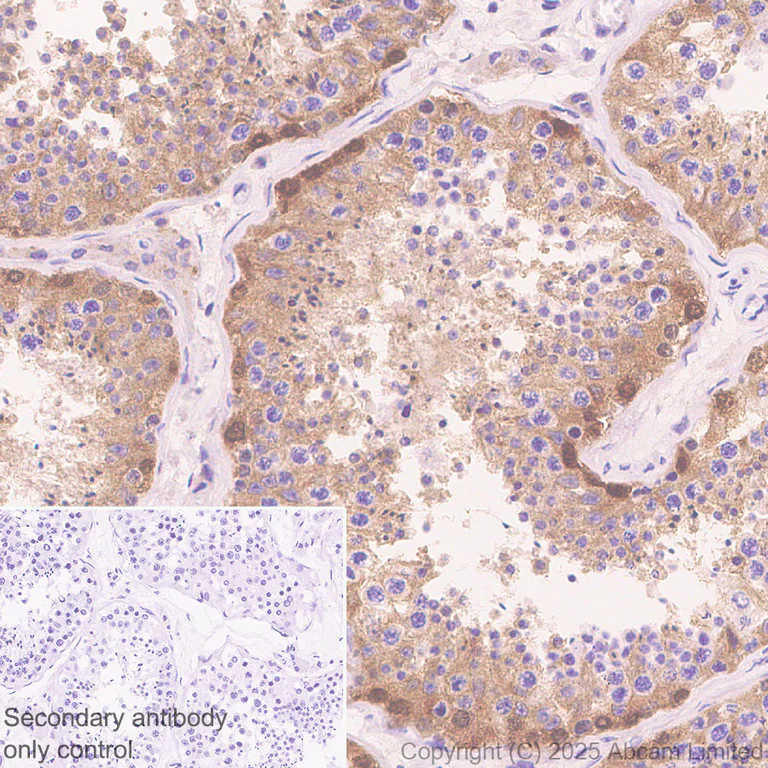 Immunohistochemistry (Formalin/PFA-fixed paraffin-embedded sections) - Anti-Von Hippel Lindau/VHL antibody [EPR30583-645] (AB324676)