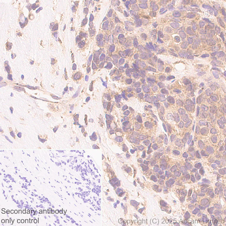 Immunohistochemistry (Formalin/PFA-fixed paraffin-embedded sections) - Anti-Von Hippel Lindau/VHL antibody [EPR30583-645] (AB324676)