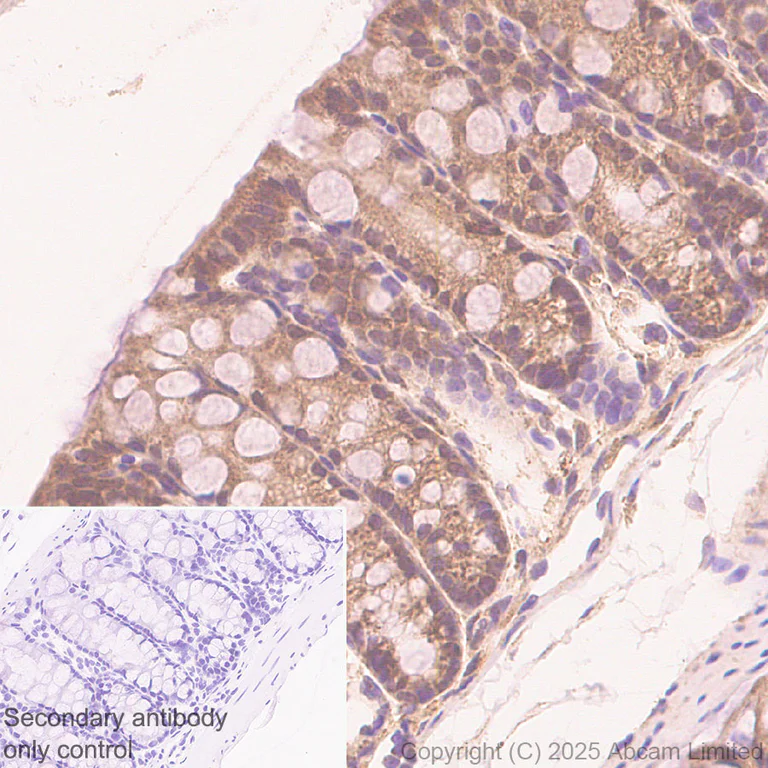 Immunohistochemistry (Formalin/PFA-fixed paraffin-embedded sections) - Anti-Von Hippel Lindau/VHL antibody [EPR30583-645] (AB324676)