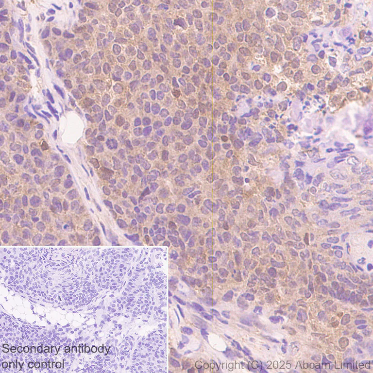 Immunohistochemistry (Formalin/PFA-fixed paraffin-embedded sections) - Anti-Von Hippel Lindau/VHL antibody [EPR30583-645] (AB324676)