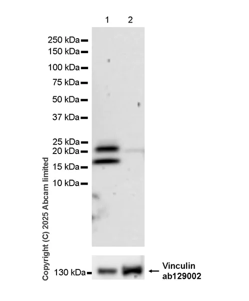 Western blot - Anti-Von Hippel Lindau/VHL antibody [EPR30583-645] (AB324676)
