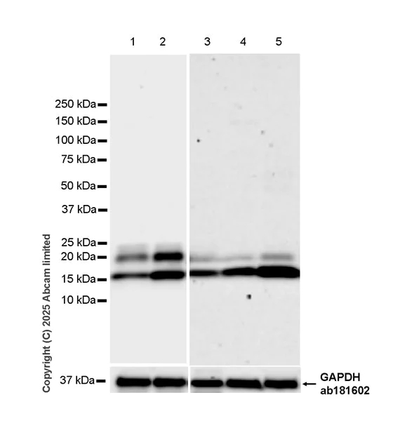 Western blot - Anti-Von Hippel Lindau/VHL antibody [EPR30583-645] (AB324676)