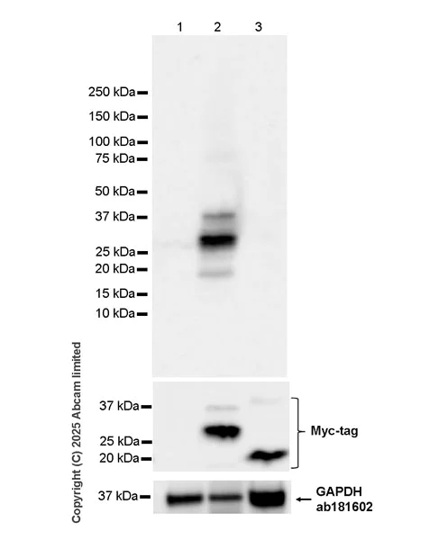 Western blot - Anti-Von Hippel Lindau/VHL antibody [EPR30583-645] (AB324676)