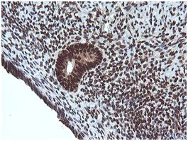 Immunohistochemistry (Formalin/PFA-fixed paraffin-embedded sections) - Anti-Von Hippel Lindau/VHL antibody [OTI1E1] (AB140989)