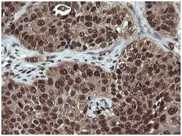 Immunohistochemistry (Formalin/PFA-fixed paraffin-embedded sections) - Anti-Von Hippel Lindau/VHL antibody [OTI1E1] (AB140989)