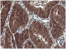 Immunohistochemistry (Formalin/PFA-fixed paraffin-embedded sections) - Anti-Von Hippel Lindau/VHL antibody [OTI1E1] (AB140989)