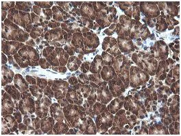 Immunohistochemistry (Formalin/PFA-fixed paraffin-embedded sections) - Anti-Von Hippel Lindau/VHL antibody [OTI1E1] (AB140989)