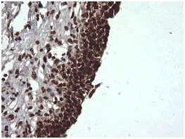 Immunohistochemistry (Formalin/PFA-fixed paraffin-embedded sections) - Anti-Von Hippel Lindau/VHL antibody [OTI1E1] (AB140989)