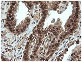 Immunohistochemistry (Formalin/PFA-fixed paraffin-embedded sections) - Anti-Von Hippel Lindau/VHL antibody [OTI1E1] (AB140989)