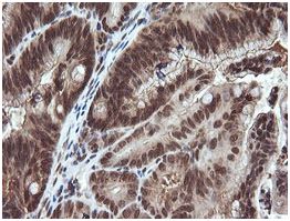 Immunohistochemistry (Formalin/PFA-fixed paraffin-embedded sections) - Anti-Von Hippel Lindau/VHL antibody [OTI1E1] (AB140989)