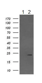 Western blot - Anti-Von Hippel Lindau/VHL antibody [OTI1E1] (AB140989)