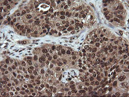 Immunohistochemistry (Formalin/PFA-fixed paraffin-embedded sections) - Anti-Von Hippel Lindau/VHL antibody [OTI1E1] - BSA and Azide free (AB273655)