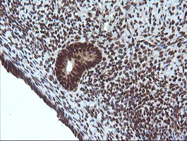 Immunohistochemistry (Formalin/PFA-fixed paraffin-embedded sections) - Anti-Von Hippel Lindau/VHL antibody [OTI1E1] - BSA and Azide free (AB273655)