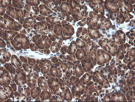 Immunohistochemistry (Formalin/PFA-fixed paraffin-embedded sections) - Anti-Von Hippel Lindau/VHL antibody [OTI1E1] - BSA and Azide free (AB273655)