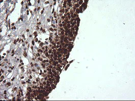 Immunohistochemistry (Formalin/PFA-fixed paraffin-embedded sections) - Anti-Von Hippel Lindau/VHL antibody [OTI1E1] - BSA and Azide free (AB273655)